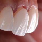 The Hollywood Smile Clinic Portfolio of Life-Changing Smiles