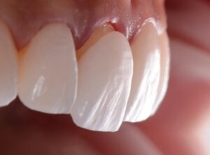 The Hollywood Smile Clinic Portfolio of Life-Changing Smiles